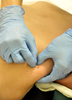 insync_physio_ims_01