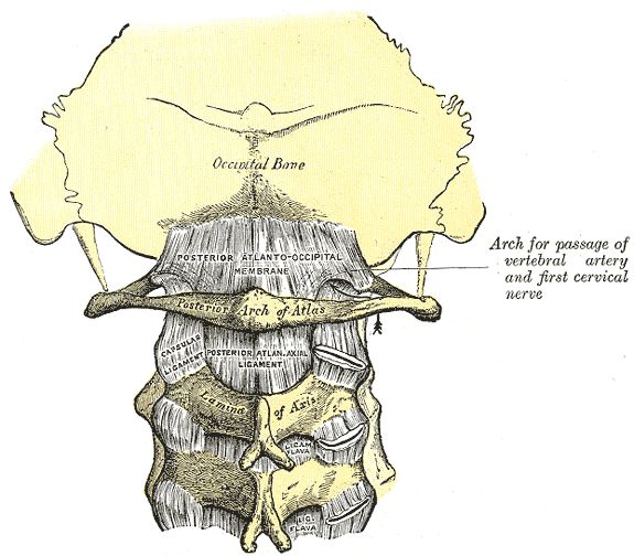 Wryneck (torticollis): Causes, types, and treatments