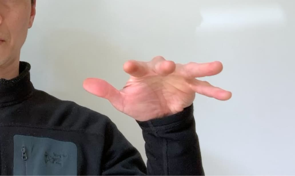 Hand and Finger Injuries Rock Climbing Rehab Hand Intrinsic Muscle