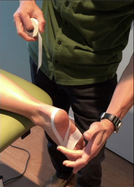 Foot and Heel Pain – Low Dye Tape Support